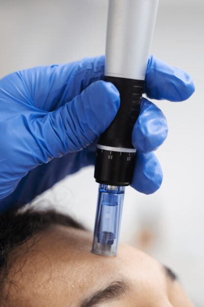 SkinPen